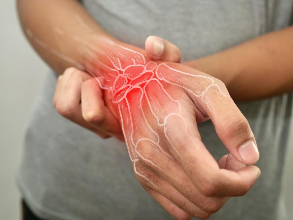 Affrontare l'Artrite Reumatoide con la Fisioterapia: Strategie Efficaci per il Controllo dei Sintomi