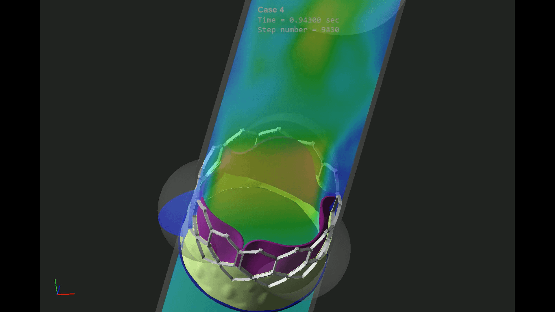 Fluid Structure Interaction for Simulation and Validation of Transcatheter Heart Valve