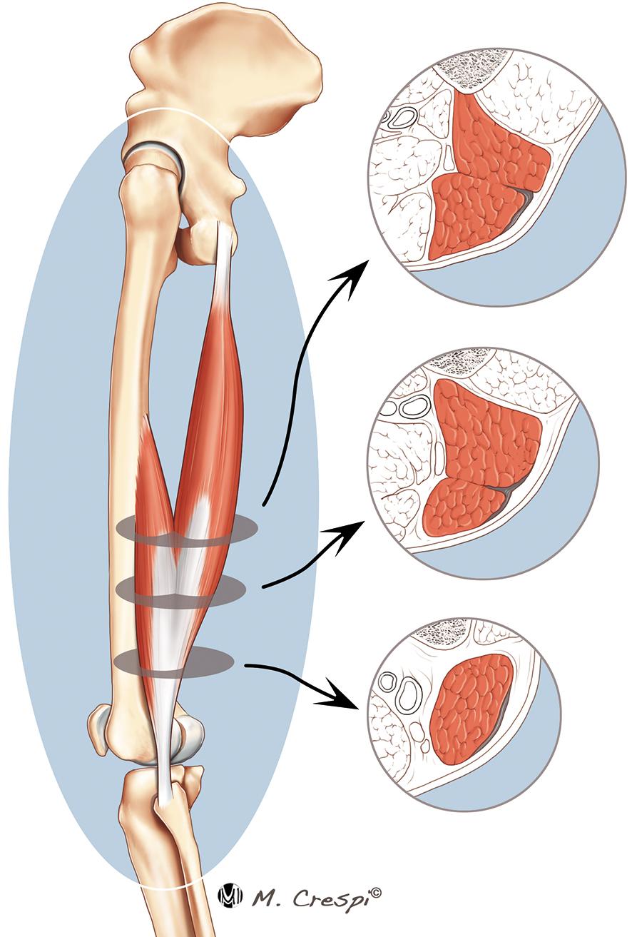 Axial cross-sections depicting the myotendinous junction anatomy