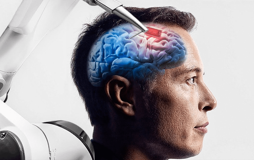 Musk dice che entro sei mesi inserirà un chip in un cervello umano