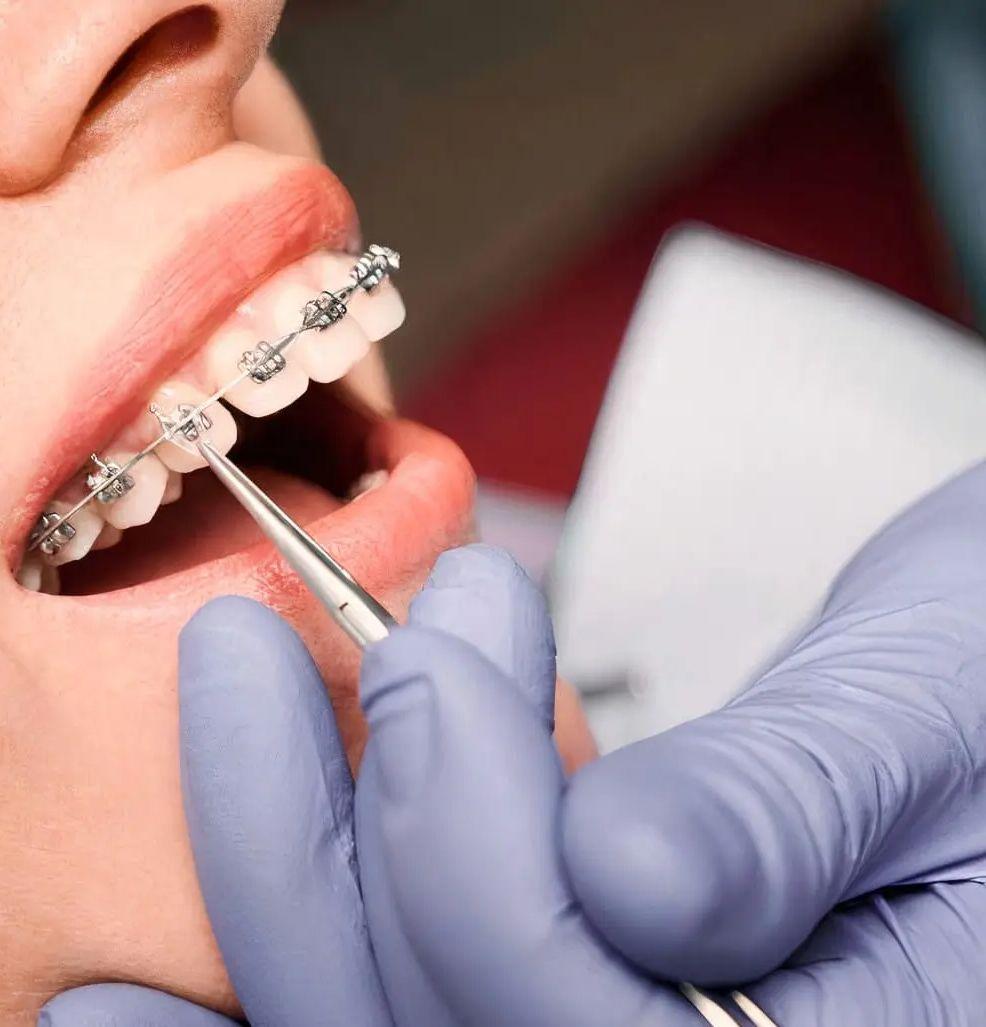 Ortodonzia professionale Clinica dentale dott. Gino Ambrosio San Giuseppe Vesuviano