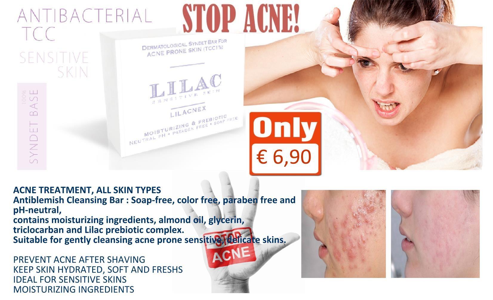 Lilac Bar Stop ACNE Antibacterial