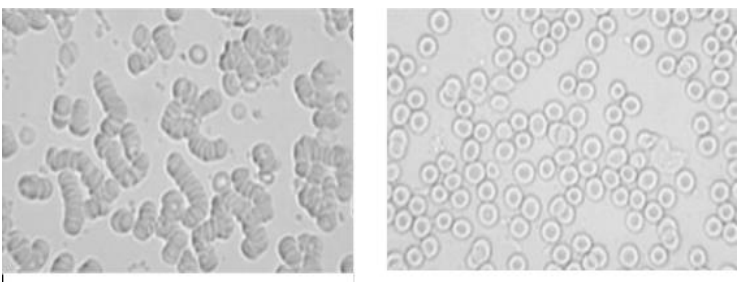 Cosa succede quando le cellule perdono energia?