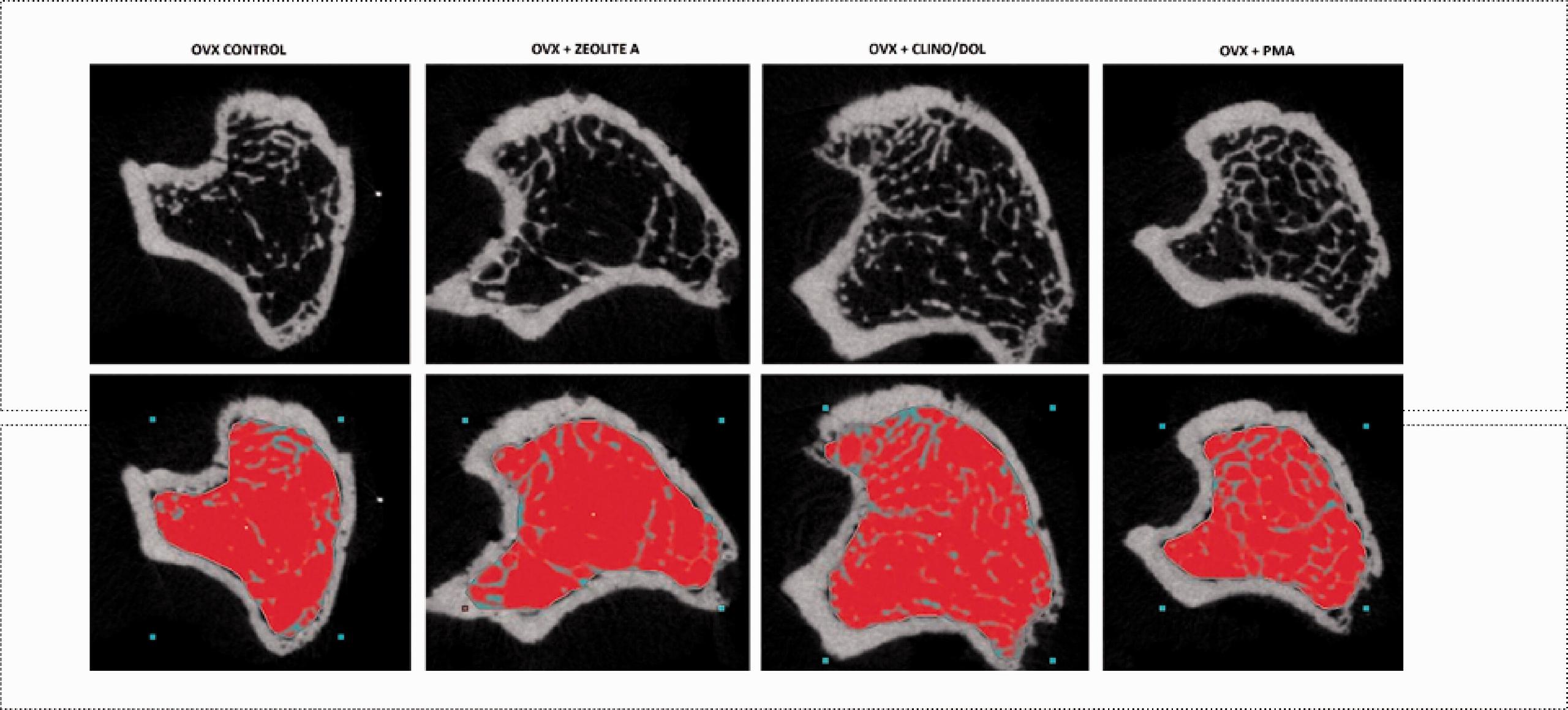 Il trattamento dell'osteoporosi con una zeolite modificata mostra effetti benefici in un modello di ratto osteoporotico e in uno studio clinico sull'uomo