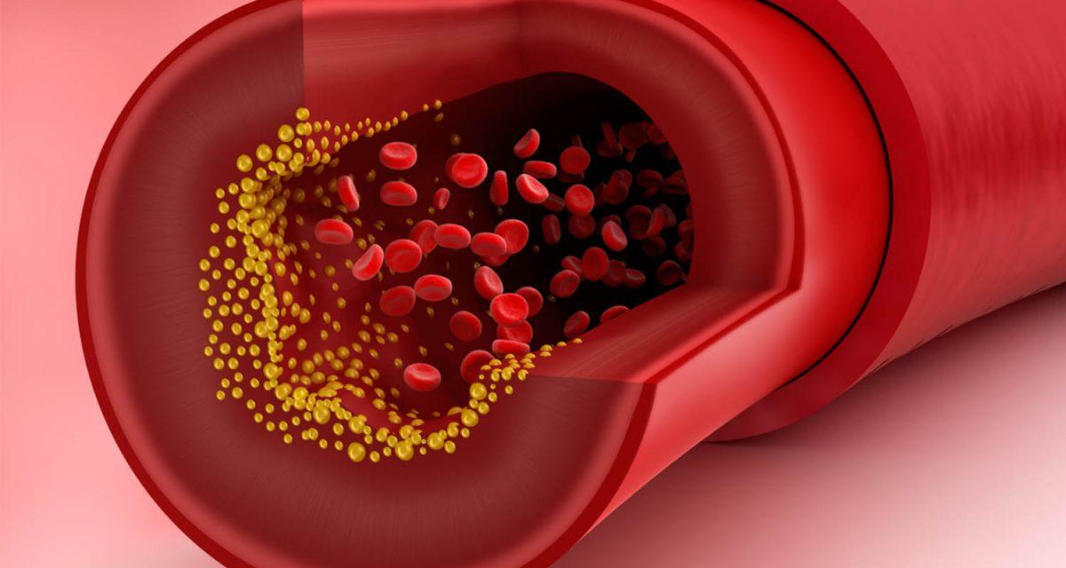 La zeolite migliora l'iperglicemia, l'iperlipidemia e l'obesità indotte da una dieta ricca di grassi