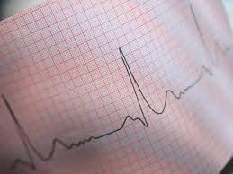 ECG e Holter a domicilio